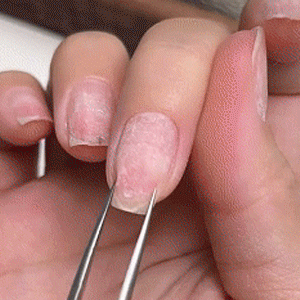 Professional Nail Treatment Bottle